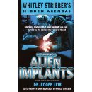 Casebook: Alien Implants