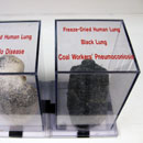 Black Lung - Coal Worker's Pneumoconiosis