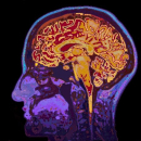 Brain Scan