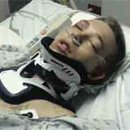 Photo: Police Taser Boy with Broken Back 19 Times